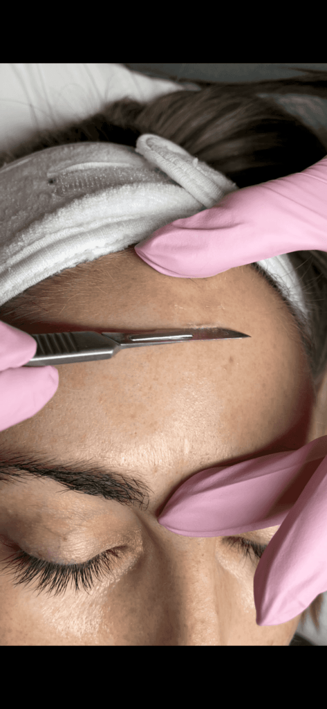 Dermaplane Facials in San Carlos IV Bar | California