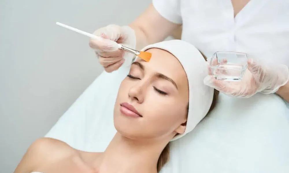 Chemical Peels by San Carlos IV and Medical Aesthetic Bar in San Carlos, CA